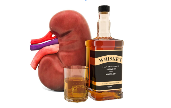 does alcohol cause kidney stones