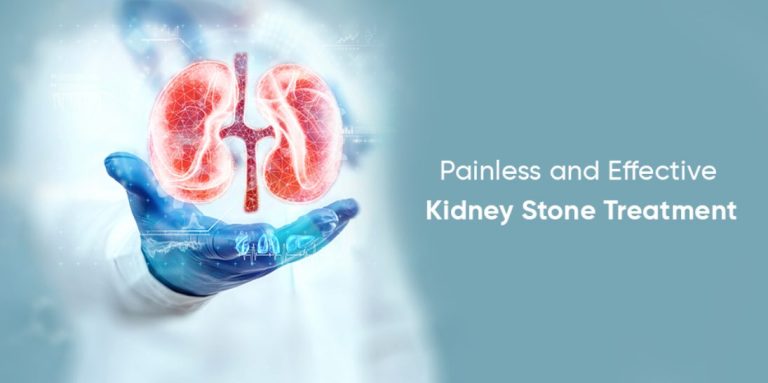 best painless kidney stone treatment