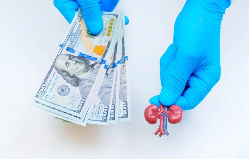 cheapest kidney stone treatment