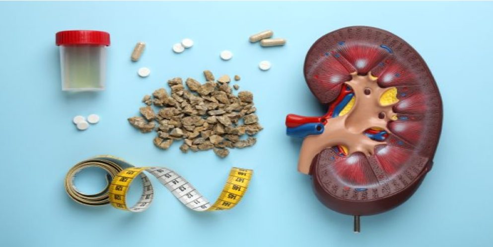 what causes kidney stones